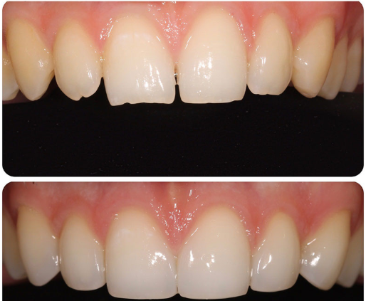 How a Dentist in Cardiff Can Fix Common Smile Concerns Dentist in Cardiff